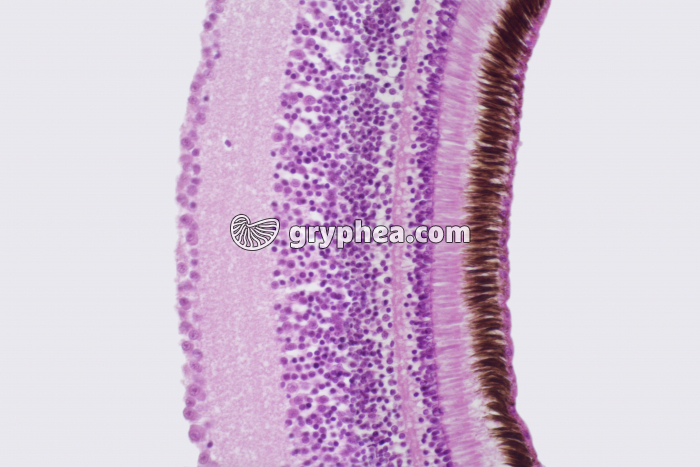 Rétine x100 - gryphea.org